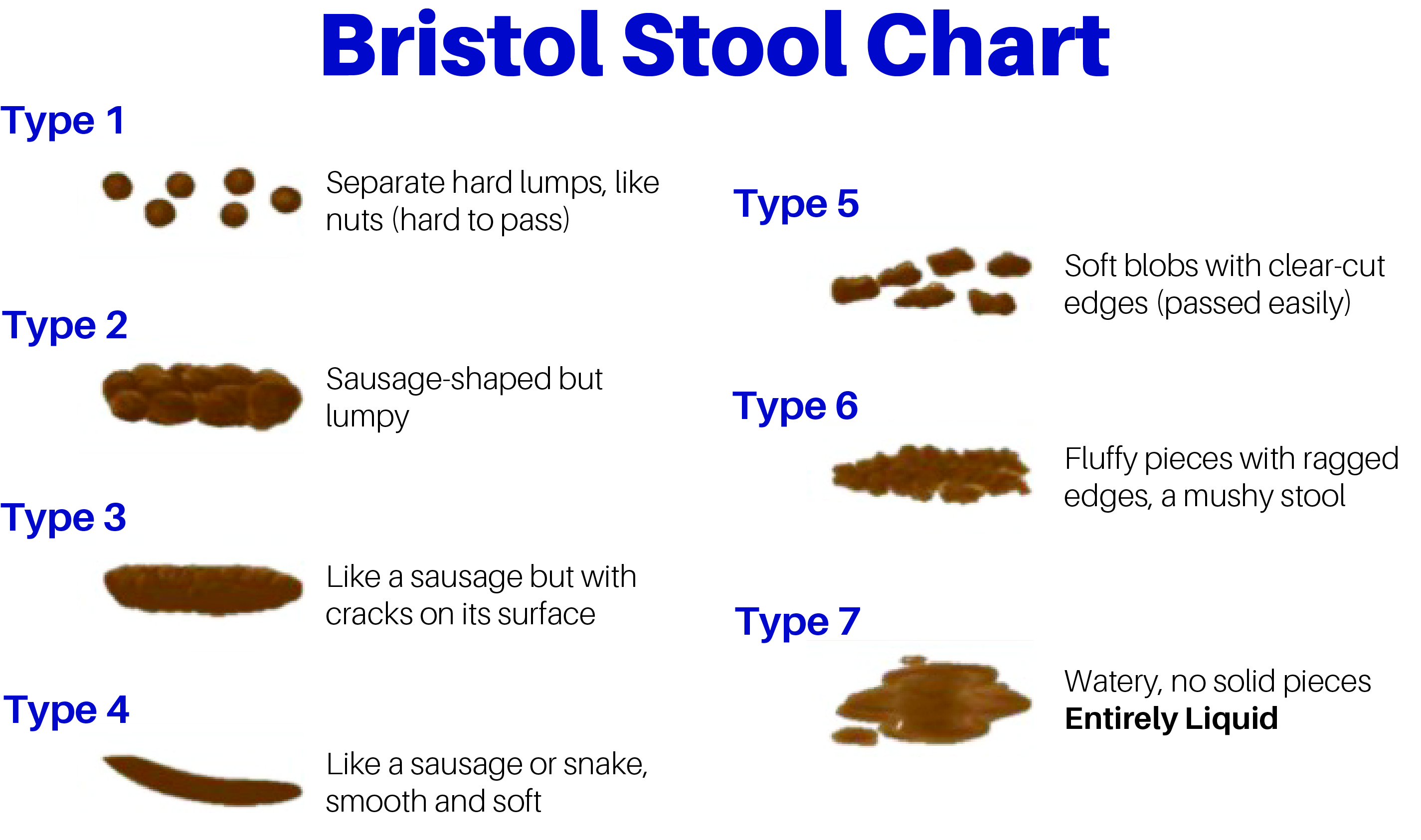 Bristol Stool chart
