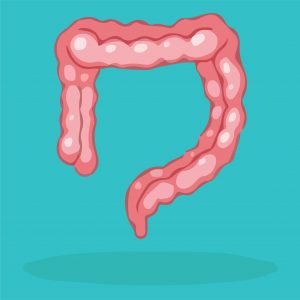Colonic inertia is condition with digestive tract paralysis that affects the colon or large intestine