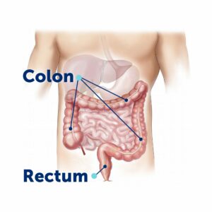 Colon and rectum for colonoscopy during colon cancer awareness month